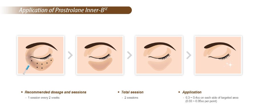 Prostrolane Inner B SE injections