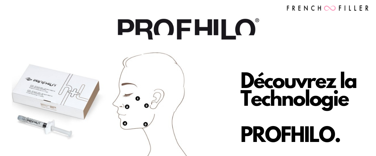 Injection Profhilo