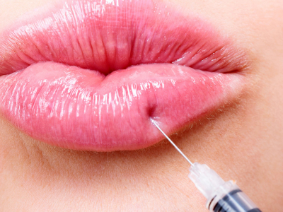 Comment choisir son acide hyaluronique pour les lèvres ?